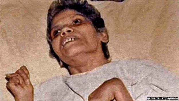 Aruna Shanbaug: Brain-damaged India nurse dies 42 years after rape